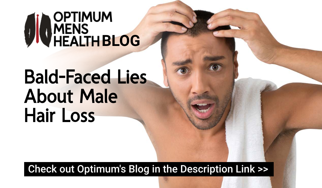 Bald-Faced Lies About Male Hair Loss read about it in Optimum's Health Blog